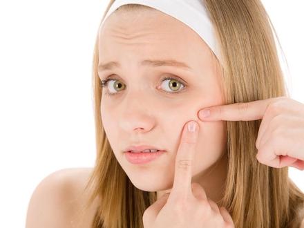 Как избавиться от следов от прыщей на лице?