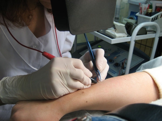 Как осветлить волосы на руках?